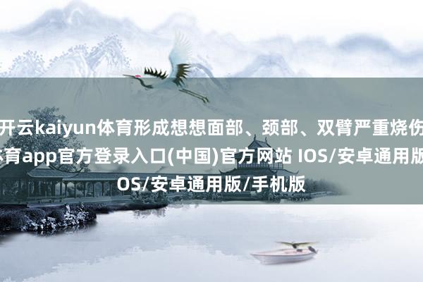 开云kaiyun体育形成想想面部、颈部、双臂严重烧伤-kai云体育app官方登录入口(中国)官方网站 IOS/安卓通用版/手机版